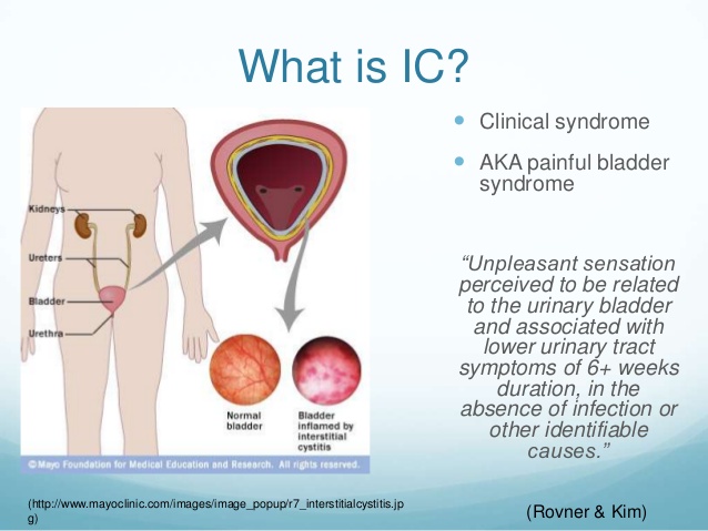 Warren recommends best of Interstitial cystitis and peeing during orgasm Amature mature bathing tubes